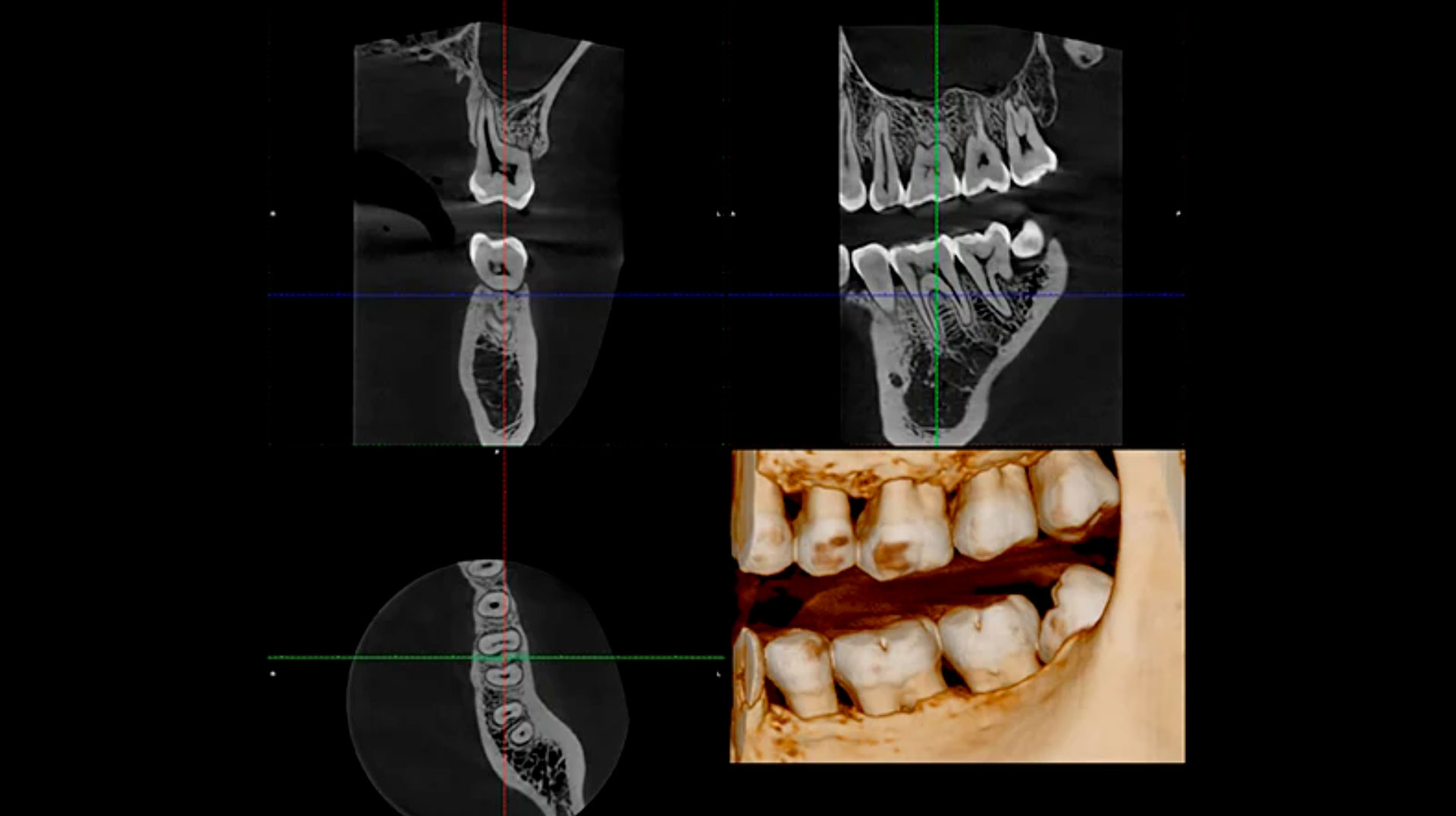 planmeca_radiografia_section_cosa_offriamo_gallery